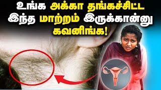 PCOD amp PCOS Symptoms amp Treatment in Tamil ஆண்பெண் தெரிந்து கொள்ளவேண்டிய பெண்களை பற்றிய விஷயங்கள் [upl. by Kemp403]