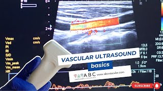 Vascular ultrasound basics [upl. by Allac330]