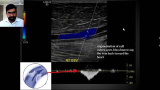 Venous Ultrasound Physiology [upl. by Demahum]