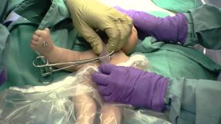 Delayed Cord Clamping [upl. by Manoff]