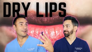 DRY CHAPPED LIPS DERMATOLOGY TIPS [upl. by Gabrielson939]