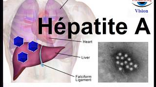 Hépatite virale A CoursdeMedecine [upl. by Ofella]