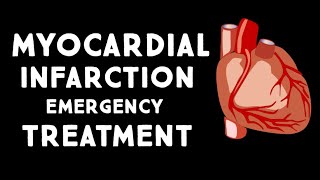 Myocardial Infarction Heart Attack for Nursing amp NCLEX [upl. by Lexine]