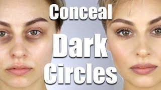 How To Conceal Dark Circles Under Eyes  Alexandra Anele [upl. by Dlaner]