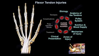 Medial Collateral Ligament injury  MCL Injuries  Everything You Need To Know  Dr Nabil Ebraheim [upl. by Lamek630]