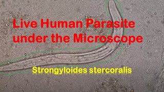 Human Parasites Live under the Microscope  Strongyloides stercoralis [upl. by Gnanmos]