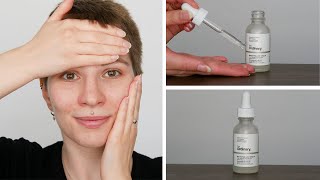 How to use The Ordinary Niacinamide 10  Zinc 1  Full Demonstration [upl. by Desirae]