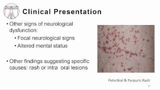 Acute Febrile EncephalopathyAcute EncephalitisAcute Encephalitic syndrome [upl. by Aicatsal]