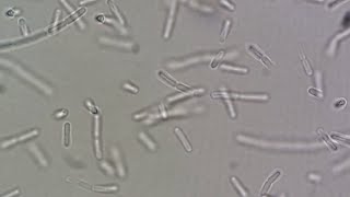 Bacillus spp [upl. by Atalanta]