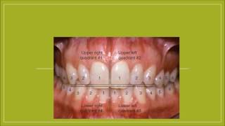 Nomenclatura dental universal palmer internacional [upl. by Melitta189]