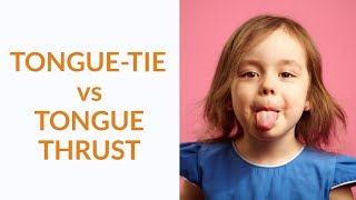 TongueTie vs Tongue Thrust  Whats The Difference [upl. by Odracer]