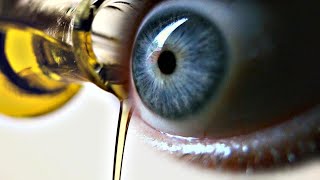 Does Castor Oil Help with Cataracts [upl. by Attekahs352]