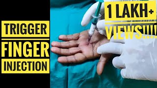 Trigger Finger Injection Technique [upl. by Gold]