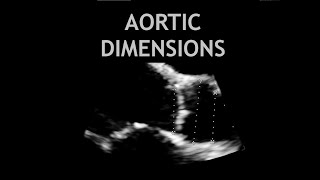 Aortic Stenosis  Heart Sounds  MEDZCOOL [upl. by Dion]