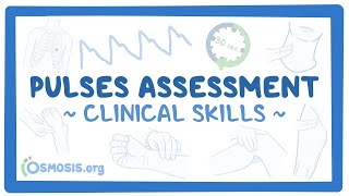 Clinical Skills Pulses assessment [upl. by Enra732]