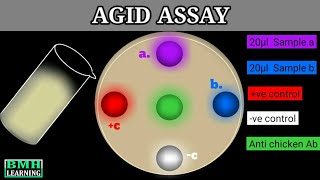 Agar Gel Immunodiffusion Assay  AGID Assay [upl. by Eunice]