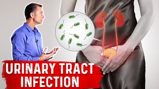 Top Natural Remedies for a UTI Urinary Tract Infection [upl. by Ramunni]