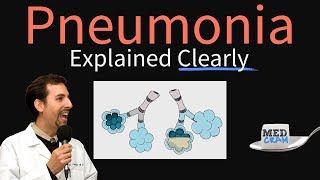 Pneumonia Explained Clearly by MedCramcom [upl. by Crysta]