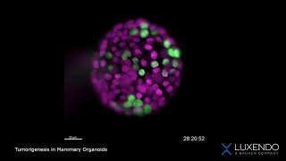 Tumorigenesis Mammary Organoids2 [upl. by Ghiselin]