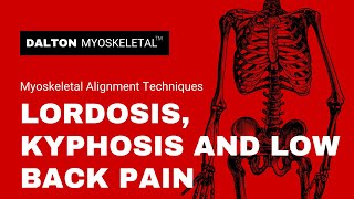 Lordosis Kyphosis and Low Back Pain [upl. by Secor]