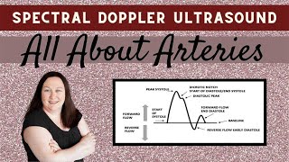 Spectral Doppler Ultrasound All About Arteries [upl. by Rosalinde]