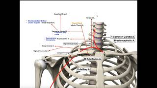 Tutorial Ultrasound Guided Subclavian Line [upl. by Kroo93]