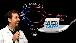 Pulmonary Artery Swan Ganz Catheter [upl. by Aneekat]