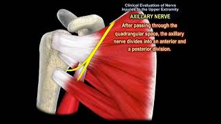 NERVE INJURY IN THE UPPER EXTREMITY Everything You Need To Know  Dr Nabil Ebraheim [upl. by Nilauqcaj]