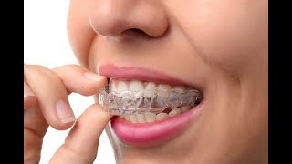 Clear aligners  Lapointe Dental Centres [upl. by North869]