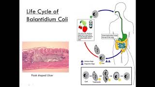 Balantidium Coli Class Ciliate Parasitology [upl. by Remmus239]