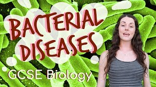 Bacterial diseases  GCSE Biology Revision for 2020 [upl. by Enicnarf]