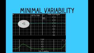 Antenatal Care  Part 1  NEET PG 2021  Dr Shonali Chandra [upl. by Aklog]