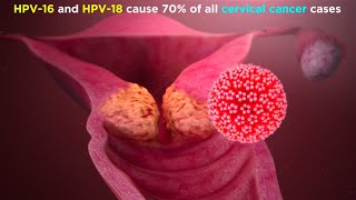 Human Papillomavirus HPV [upl. by Nuhsed]