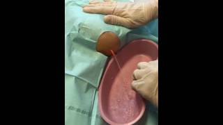 Removing Saline Implants  Elizabeth A Kinsley MD [upl. by Yorled]