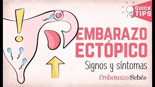 EMBARAZO ECTÓPICO 💔😭 Signos y síntomas [upl. by Button569]