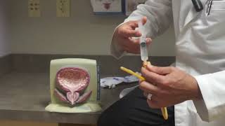 How a Bladder Catheter Works [upl. by Duleba]