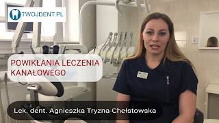 Powikłania leczenia kanałowego Twój Dentysta Grójec [upl. by Willet783]