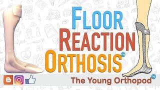 Floor Reaction Orthosis FRO [upl. by Kenzi46]