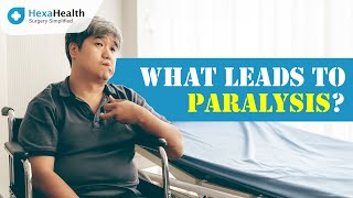 Know all about Paralysis  HexaHealth Expert Dr Sanjay Kumar Chaudhary [upl. by Rento]