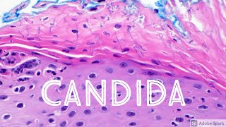 Candida Yeast Infection under microscope Candidiasis Dermatology Dermatopathology [upl. by Heppman]