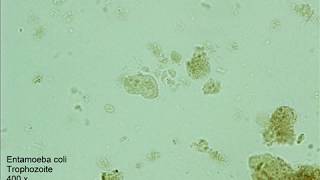 Entamoeba coli [upl. by Mathis]