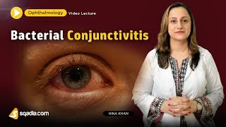 Bacterial Conjunctivitis  Ophthalmology Video Lecture  Medical Student VLearning [upl. by Berriman]