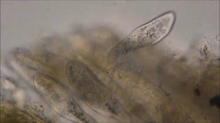 Paramecium caudatum under the microscope [upl. by Swainson]