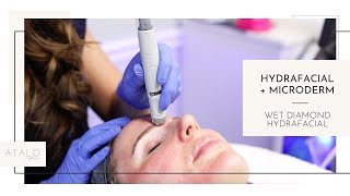 Best Microdermabrasion Technique  Wet Diamond Tip Hydrafacial [upl. by Aeirdna]