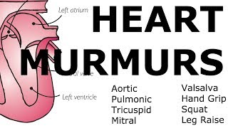 Heart Murmurs  Locations Maneuvers Buzzwords [upl. by Kaasi925]