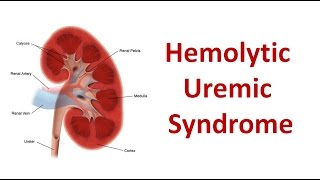 Hemolytic Uremic Syndrome [upl. by Enomyar]