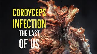 Cordyceps Infection The Last of Us Explored [upl. by Ahsaekal693]