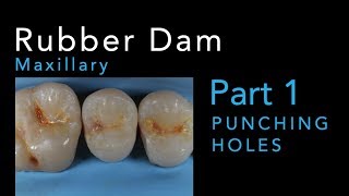 Rubber Dam Isolation Part 1 Punching Maxillary Holes [upl. by Bohun]