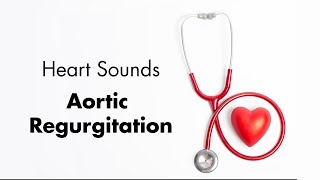 Aortic Regurgitation  Heart Sounds  MEDZCOOL [upl. by Amles]