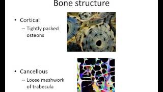 Patient Perspective Congenital hip dysplasia [upl. by Iarahs]